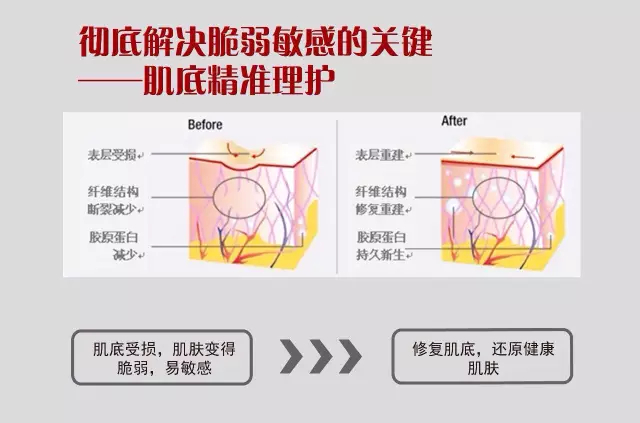 彻底解决脆弱敏感的关键是肌底精准护理