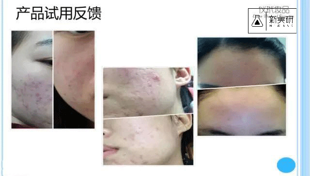 1510898274455170.jpg 3.jpg