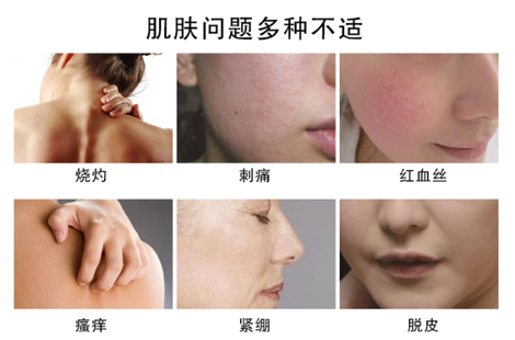 肌肤问题 肌肤问题