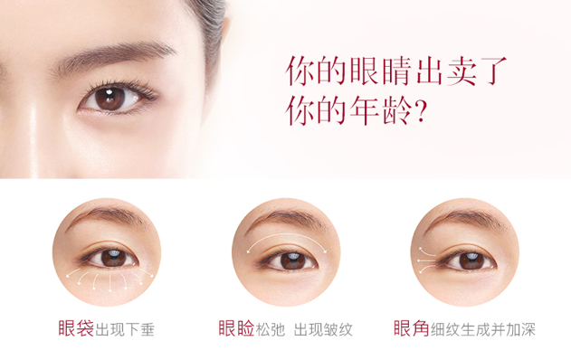 眼部问题 眼部问题