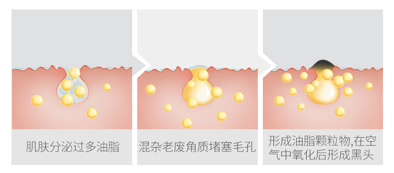 鼻头凝胶详情（白）_03.jpg