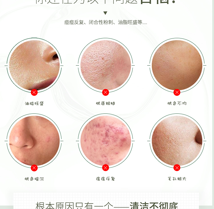 玛丽安儿碳酸泡泡清洁面膜_03.jpg