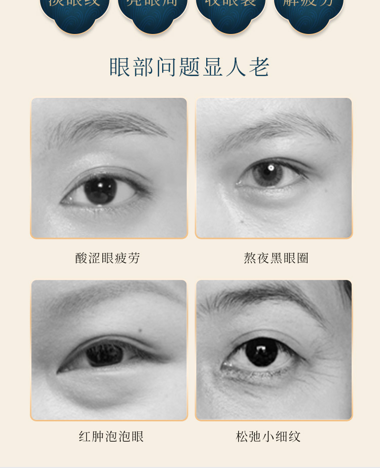 眼膜详情_02.jpg