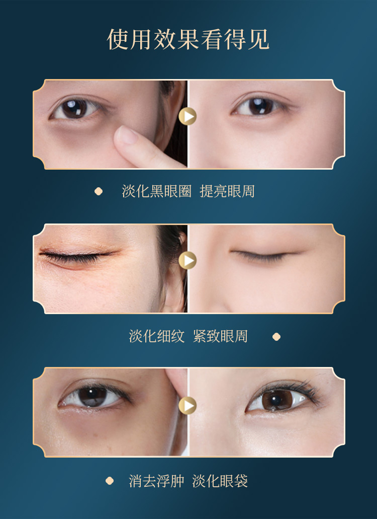 眼膜详情_10.jpg