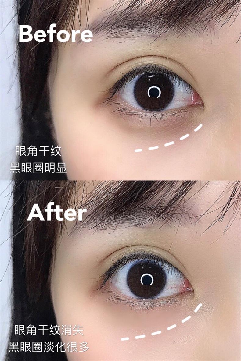 鲑鱼眼霜详情②-5_09.jpg