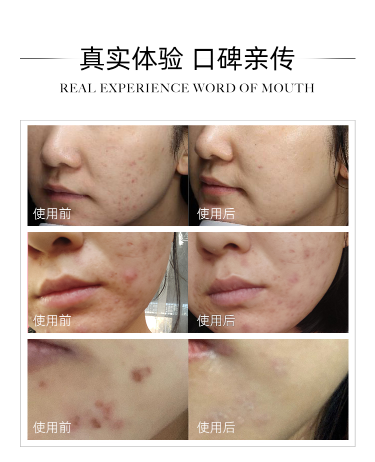 再生霜详情1_06.jpg