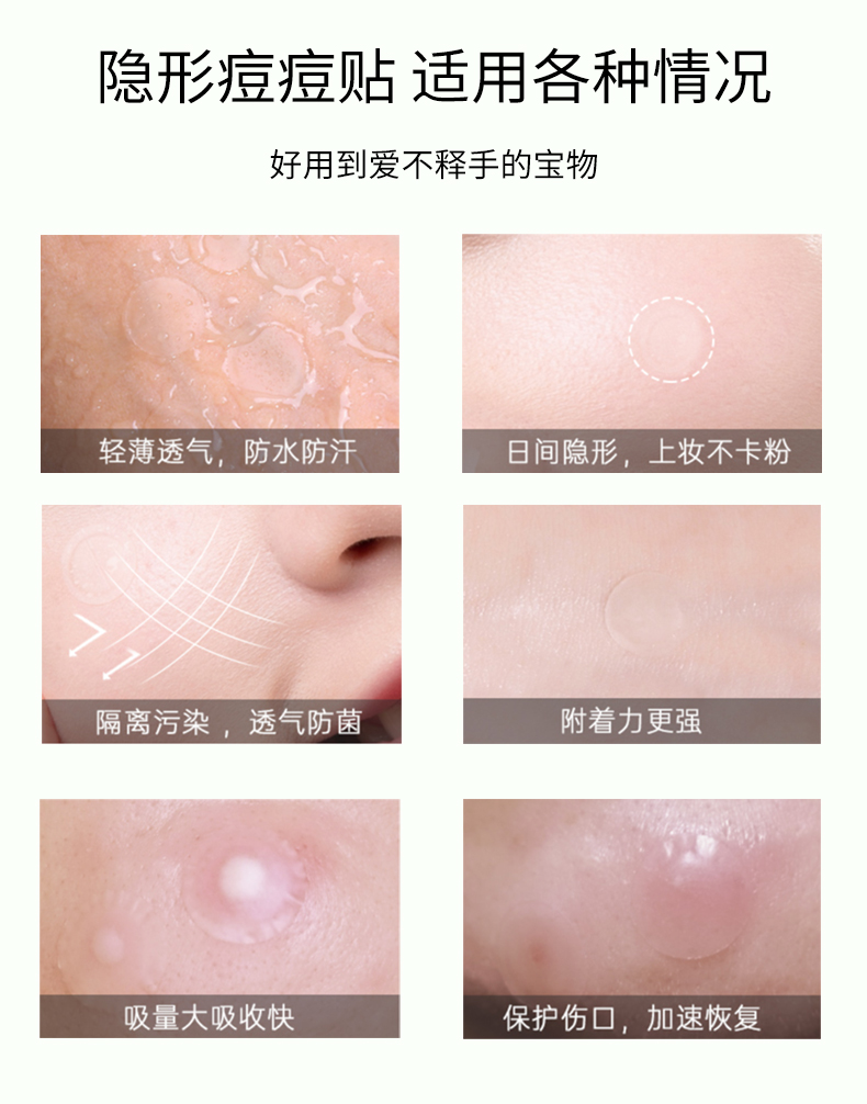 祛痘贴详情_10.jpg