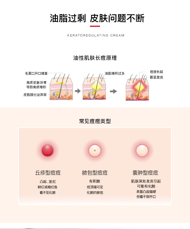 ACM角质调理霜_02.jpg