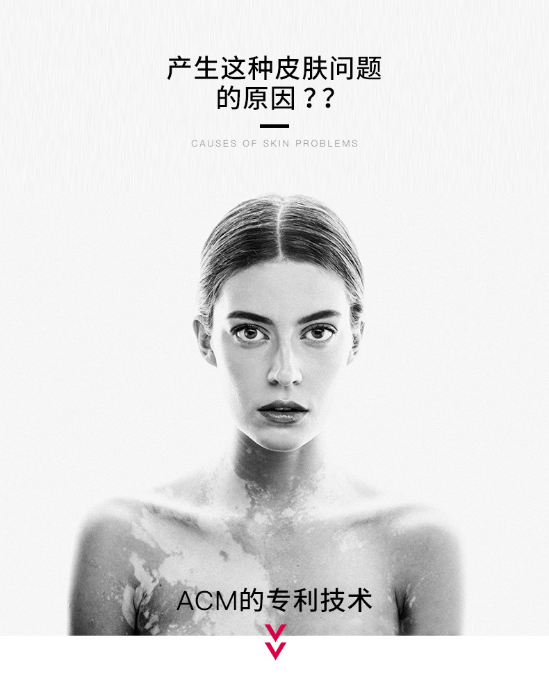 ACM均衡凝胶_02.jpg