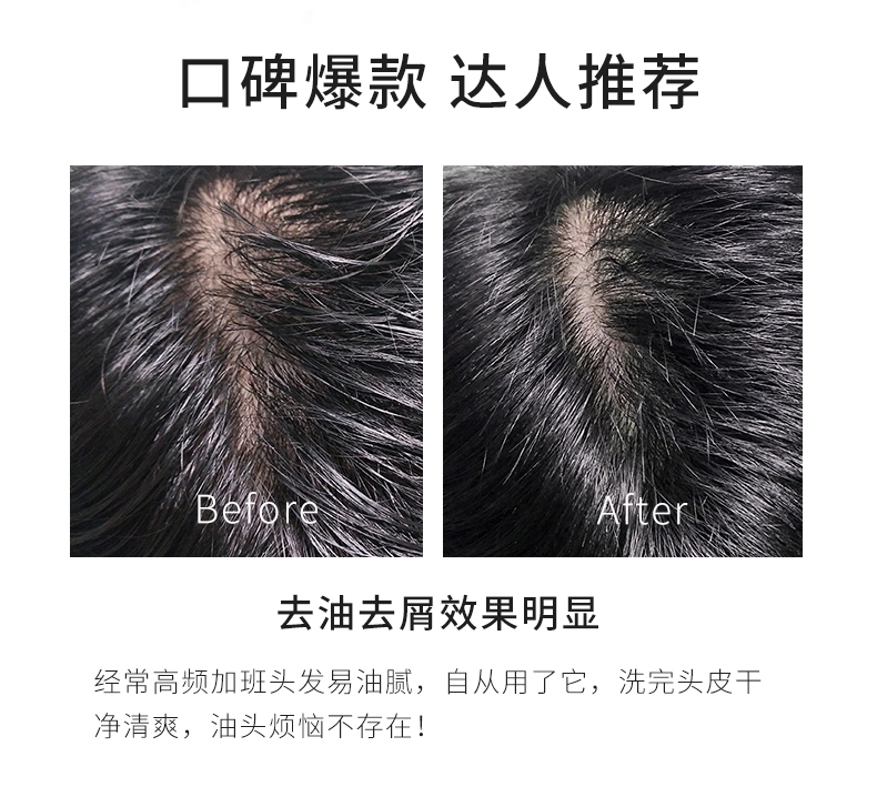 黑泥洗发水790_12.jpg