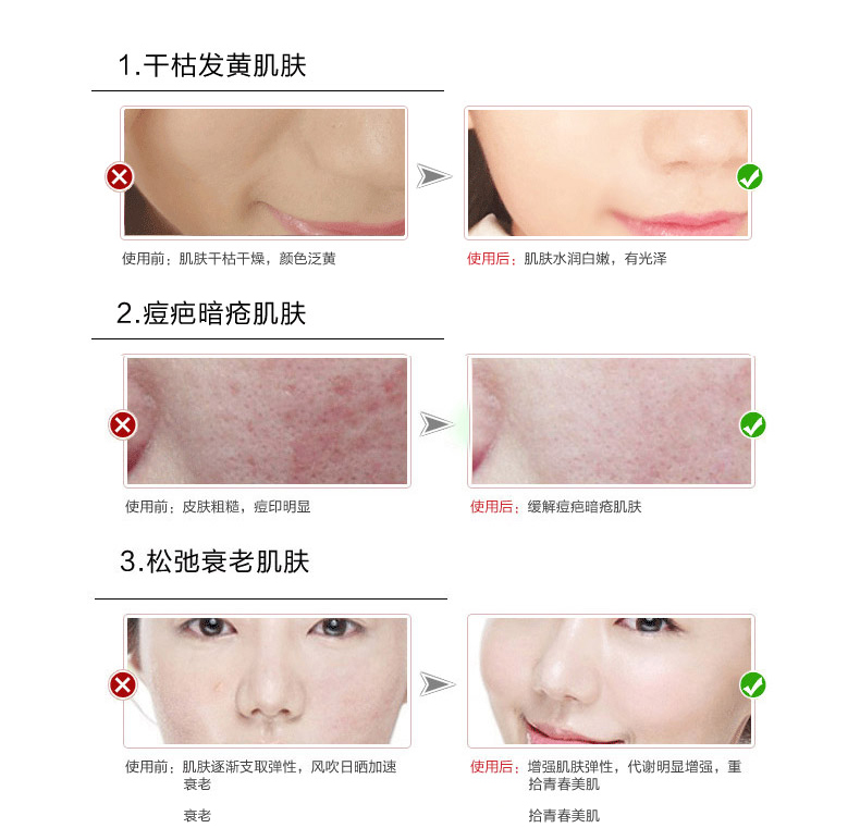 1520920272606859.jpg 008.jpg