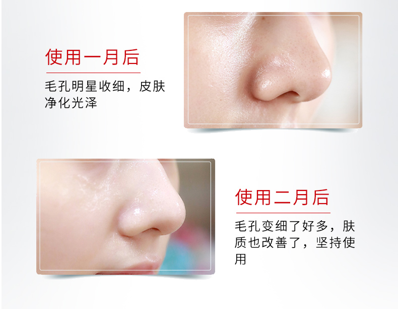 1528285850297446.jpg 鼻头凝胶详情(红)_12.jpg