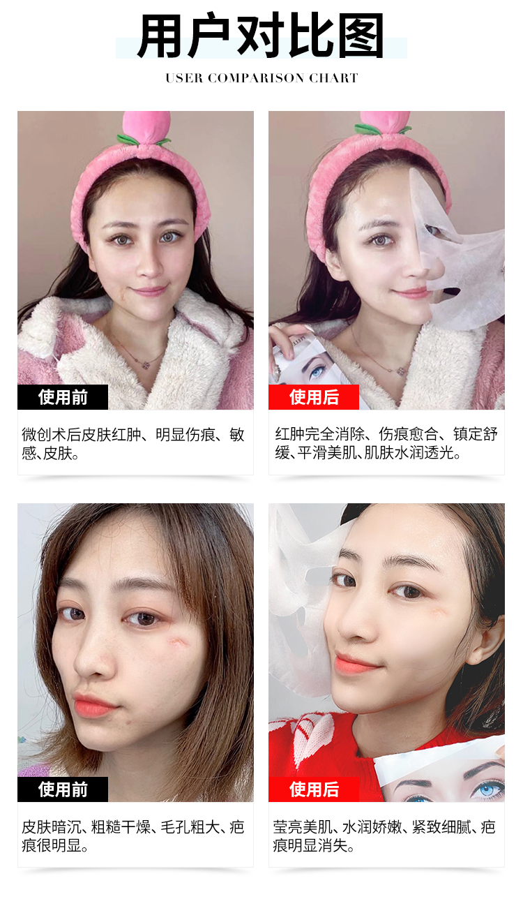 贻贝面膜1-2确定_07.jpg
