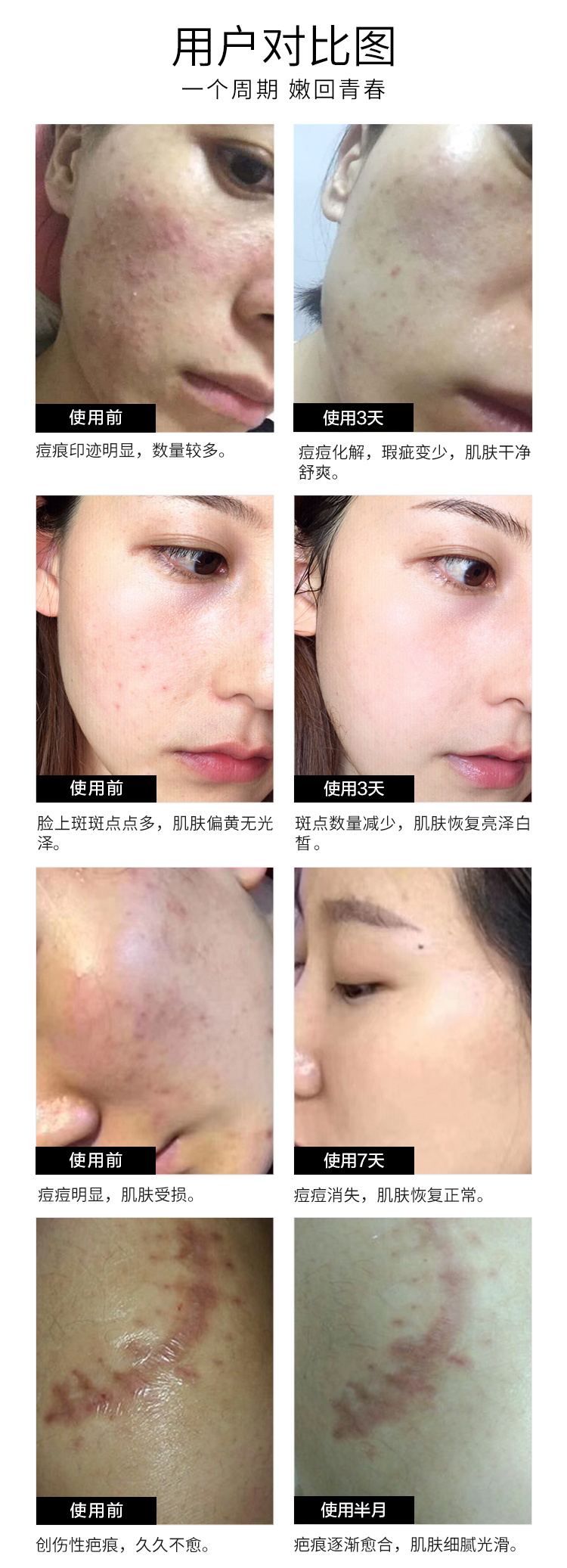 冻干粉-详情页-丽新5_12.jpg