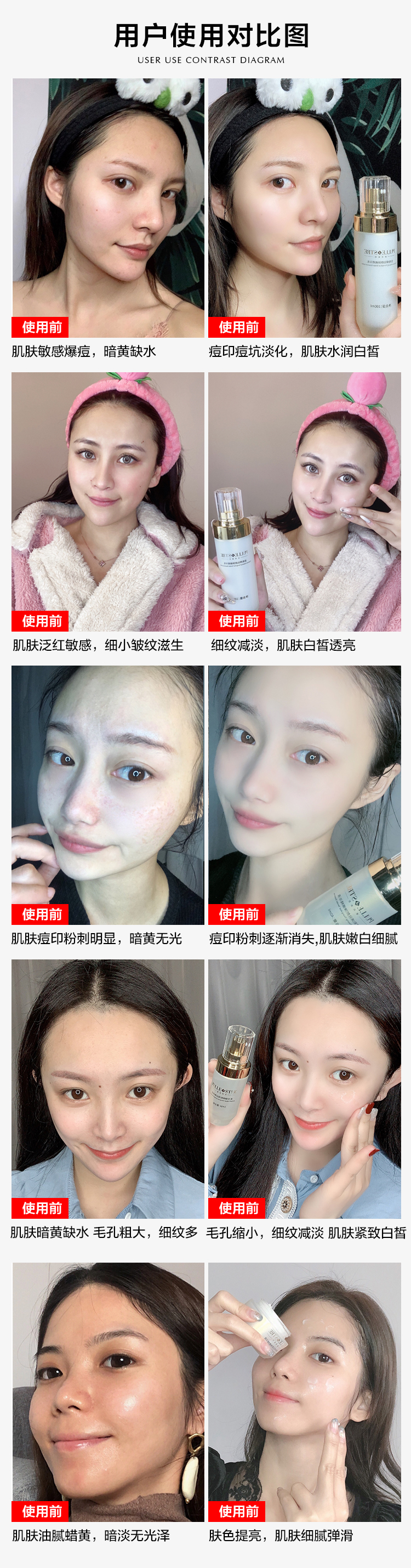 干细胞5件套-详情页4_08.jpg