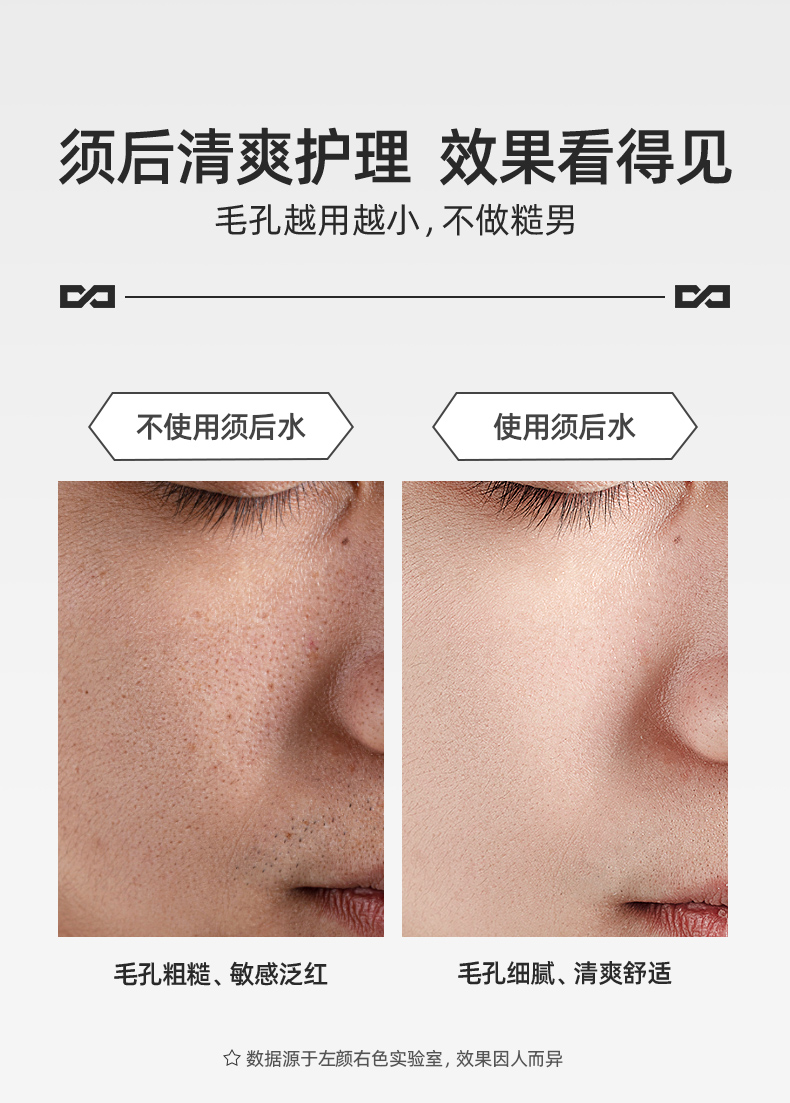 左颜右色须后啫喱水详情-切图_05.jpg