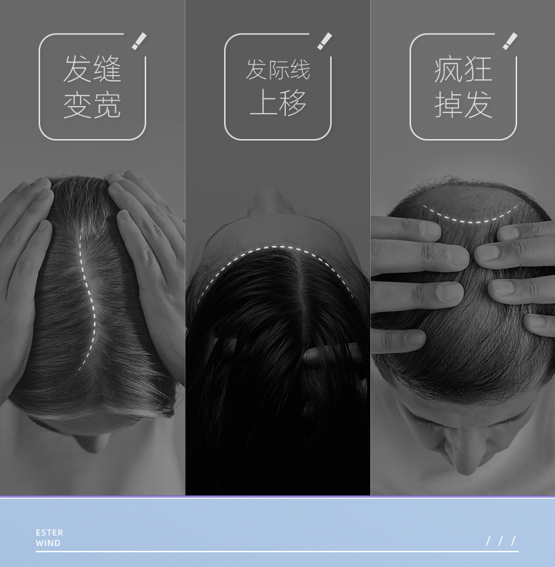 ESWIND伊风生姜育发防脱液-20210908_03.jpg